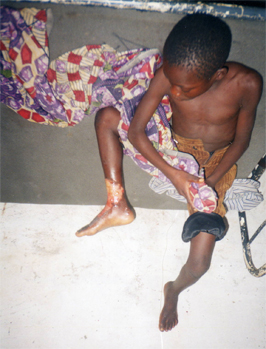 health challenges luila village